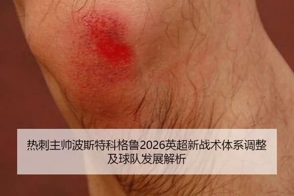 热刺主帅波斯特科格鲁2026英超新战术体系调整及球队发展解析